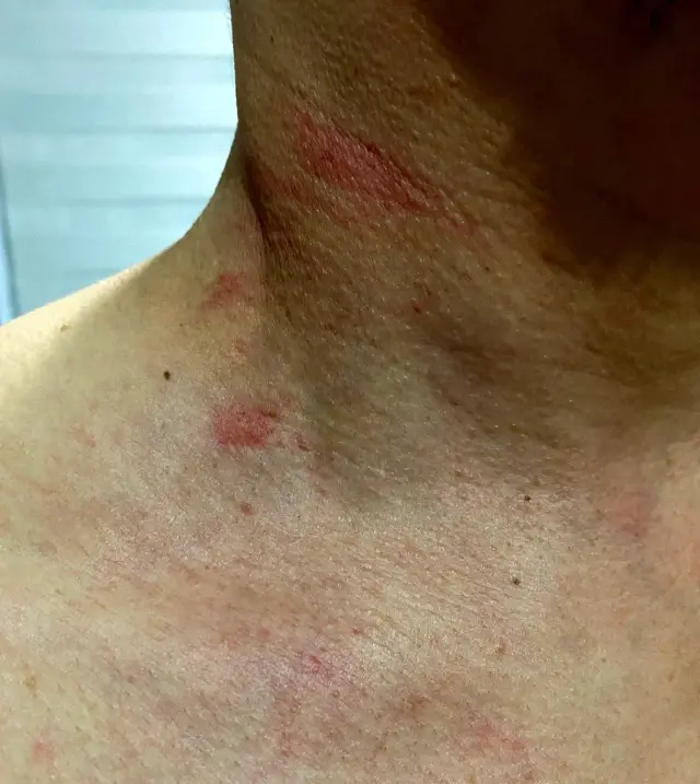 Motosikletli kurye, trafikte doktoru darp etti Motosikletli kurye, trafikte doktoru darp etti