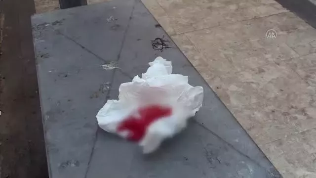 Son dakika! Ev arkadaşının silahla yaraladığı kişi hastaneye kaldırıldı Son dakika! Ev arkadaşının silahla yaraladığı kişi hastaneye kaldırıldı