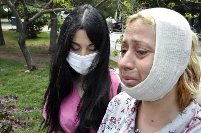 Köpek beslerken darp edildiği iddia edilen kadın yaşadıklarını anlattı: Koşarak yüzüme yumruk attı Köpek beslerken darp edildiği iddia edilen kadın yaşadıklarını anlattı: Koşarak yüzüme yumruk attı