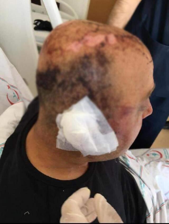 Polisi telsizle öldüresiyle döven saldırgan mahkemede olayı hatırlamadığını öne sürdü Polisi telsizle öldüresiyle döven saldırgan mahkemede olayı hatırlamadığını öne sürdü
