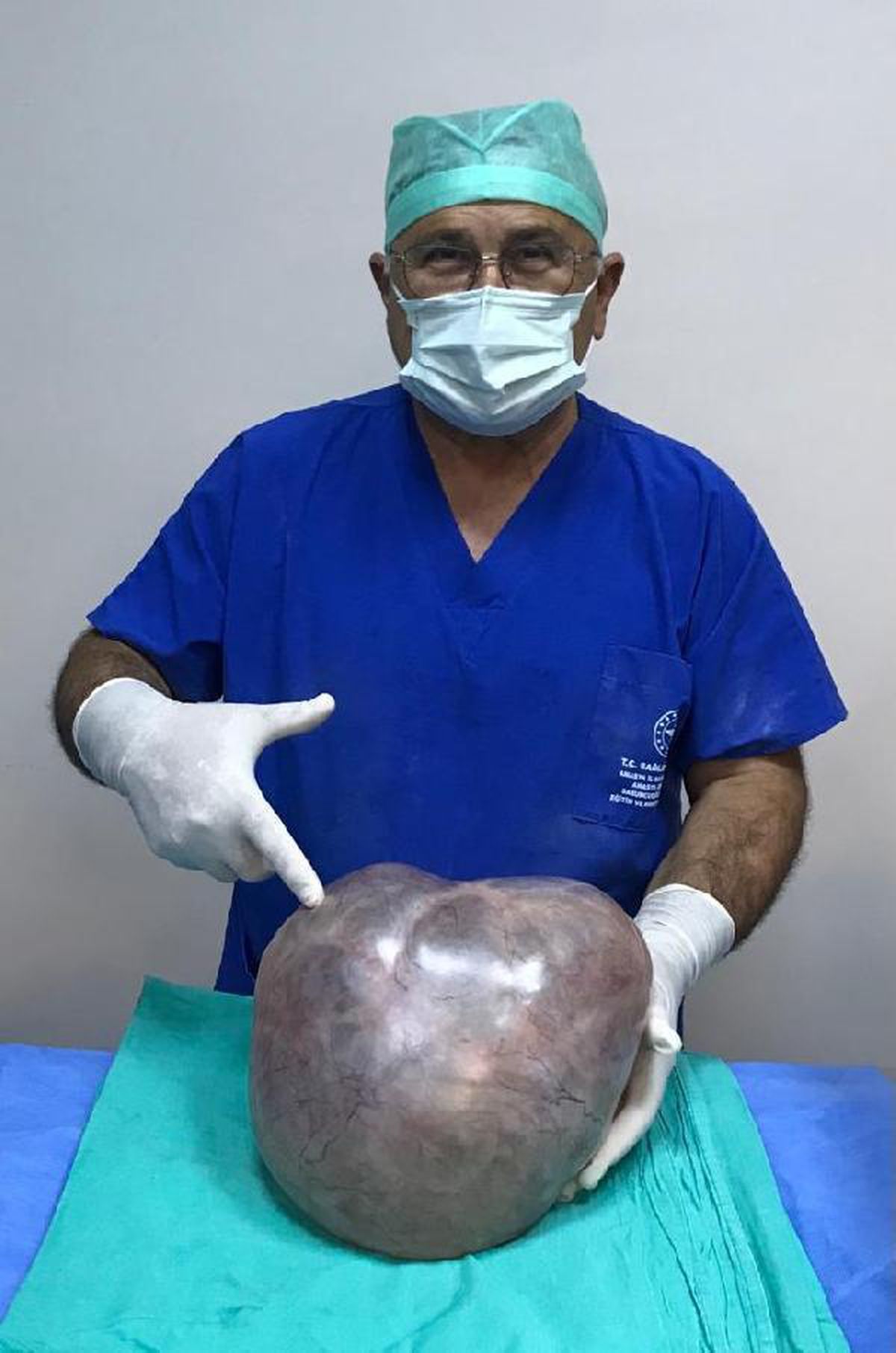 HAMİLE OLDUĞUNU DÜŞÜNEN KADININ KARNINDAN 6 KİLO 400 GRAM KİTLE ÇIKTI