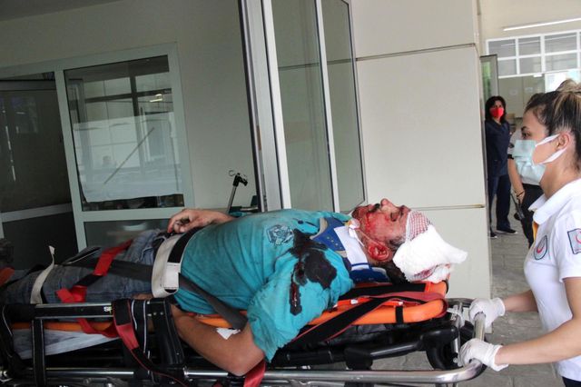 cati coktu tadilat yapan vatandas yaralandi 2 14211116 o