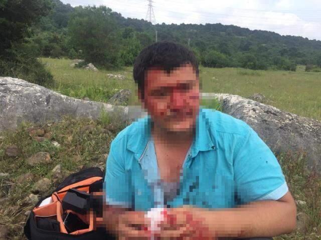 Lütfü Türkkan'ın kaçak çiftliğin yıkımını görüntüleyen muhabir darbedildi Lütfü Türkkan'ın kaçak çiftliğin yıkımını görüntüleyen muhabir darbedildi
