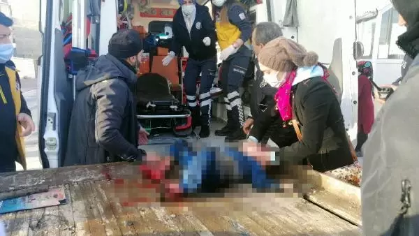 Yangında annesini kaybeden Okay'ın iki eli, bileklerinden kesildi