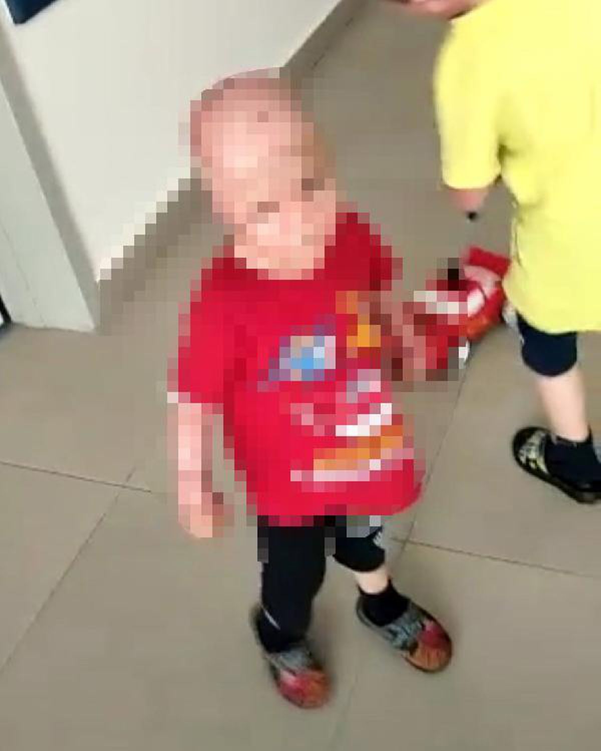 Yangında annesini kaybeden Okay'ın iki eli, bileklerinden kesildi