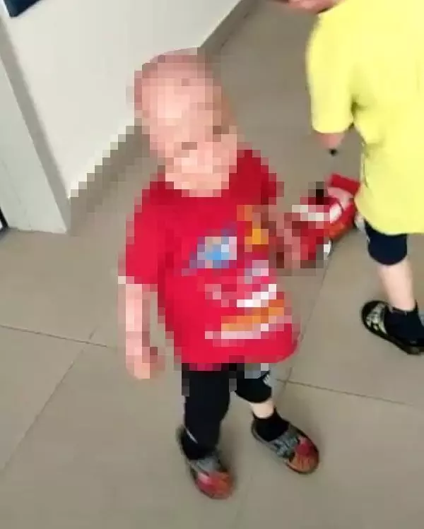 Yangında annesini kaybeden Okay'ın iki eli, bileklerinden kesildi Yangında annesini kaybeden Okay'ın iki eli, bileklerinden kesildi