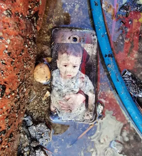 Yangında annesini kaybeden Okay'ın iki eli, bileklerinden kesildi