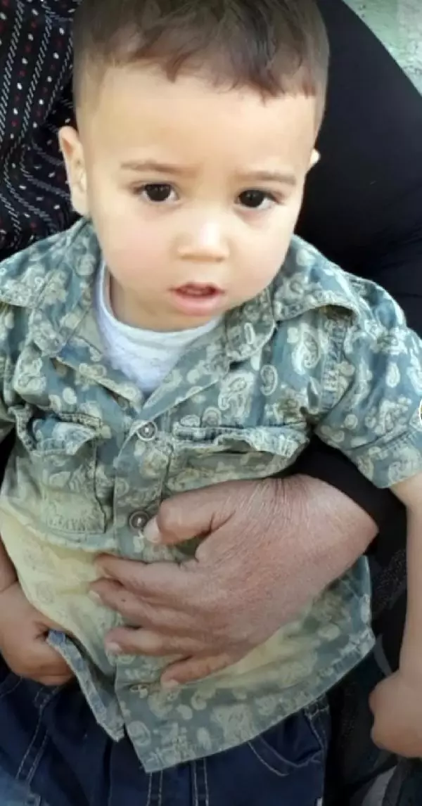 Yangında annesini kaybeden Okay'ın iki eli, bileklerinden kesildi