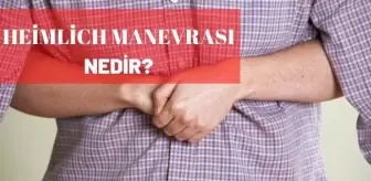 Heimlich Manevrası nedir? Heimlich Manevrası nasıl uygulanır?