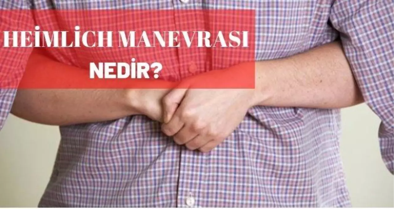 Heimlich Manevrası nedir? Heimlich Manevrası nasıl uygulanır?
