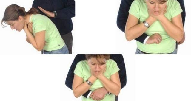 Heimlich Manevrası nedir? Heimlich Manevrası nasıl uygulanır?