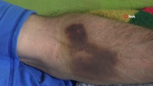 hissettigi acilar icin doktorlara yalvardi 4 14236933 o