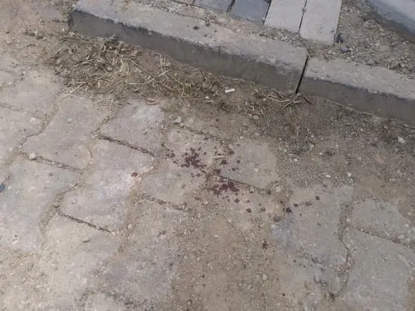 Son dakika haberi: BOŞANMA AŞAMASINDAKİ AİLELERİN KAVGASINDA ÇOCUKLAR DA YARALANDI: 6 YARALI