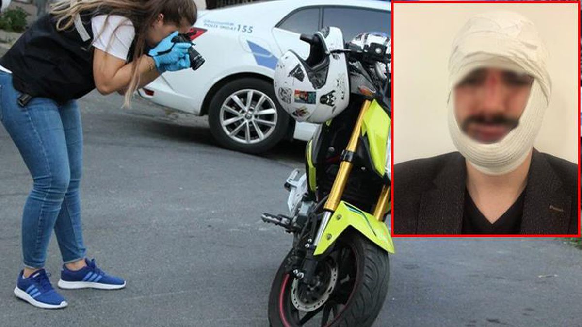 Motosikletli magandalardan muhabire öldüresiye dayak! Çenesi kırıldı, yüzüne onlarca dikiş atıldı