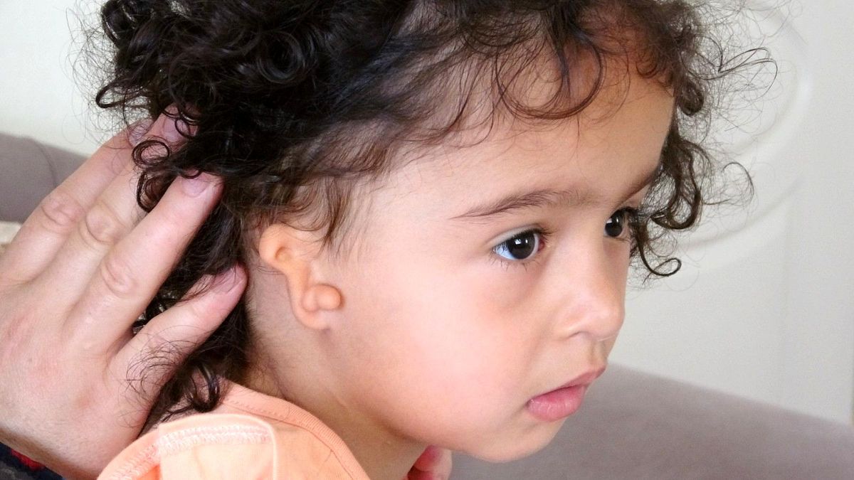 Doğuştan kulağı olmayan minik Zelal'in annesi yardım bekliyor