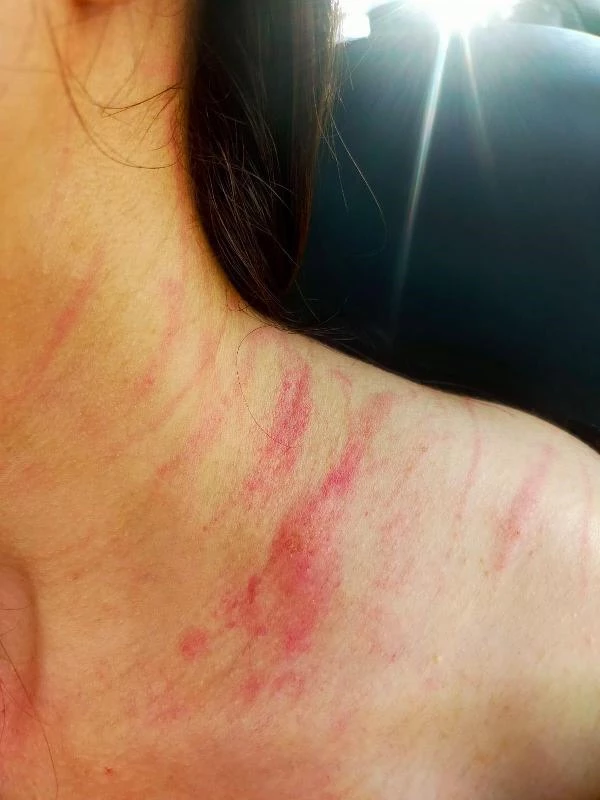 Devlet hastanesinde muayenehane kavgası! Kavga sırasında kadın doktorun boynu tırmalandı