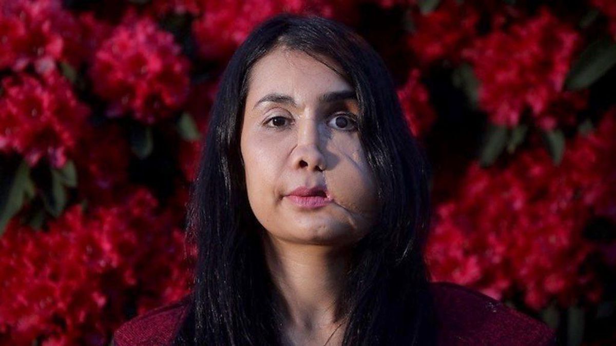 Eşi tarafından suratından vurulan Şakila Zareen, Afganistan'da kadınlara olan bakış açısını anlattı