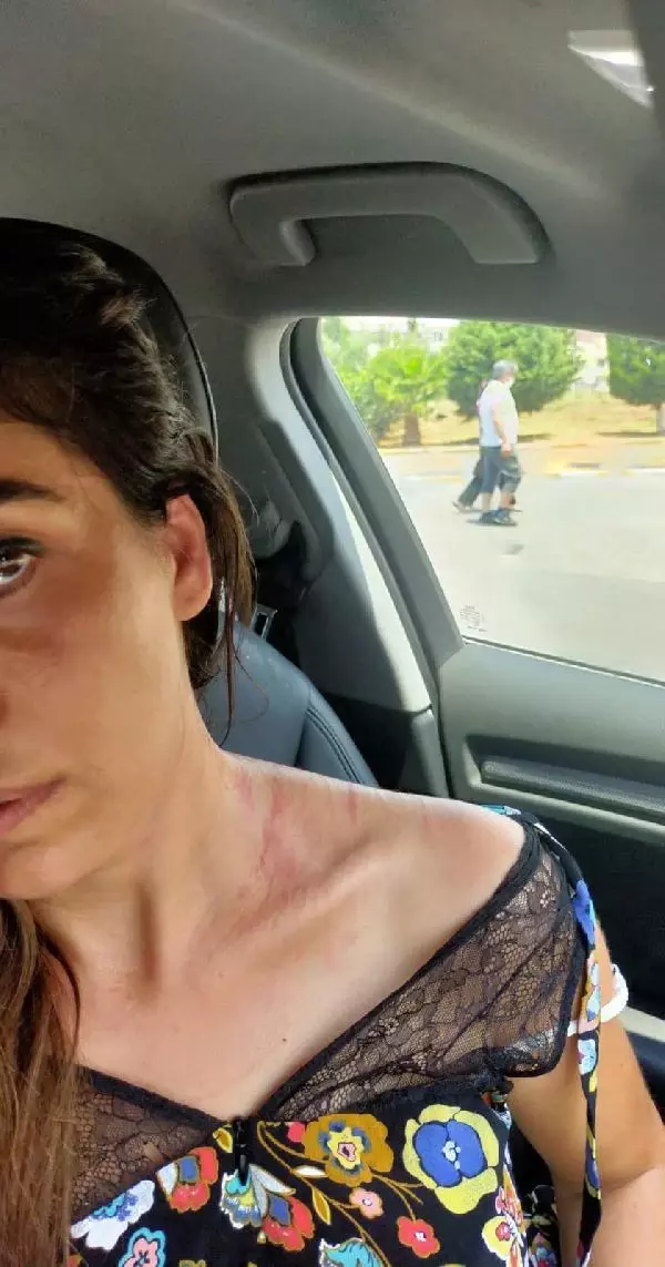 DOKTORLARIN ODA KAVGASINDA 1 AY 'YAKLAŞMAMA' TEDBİRİ