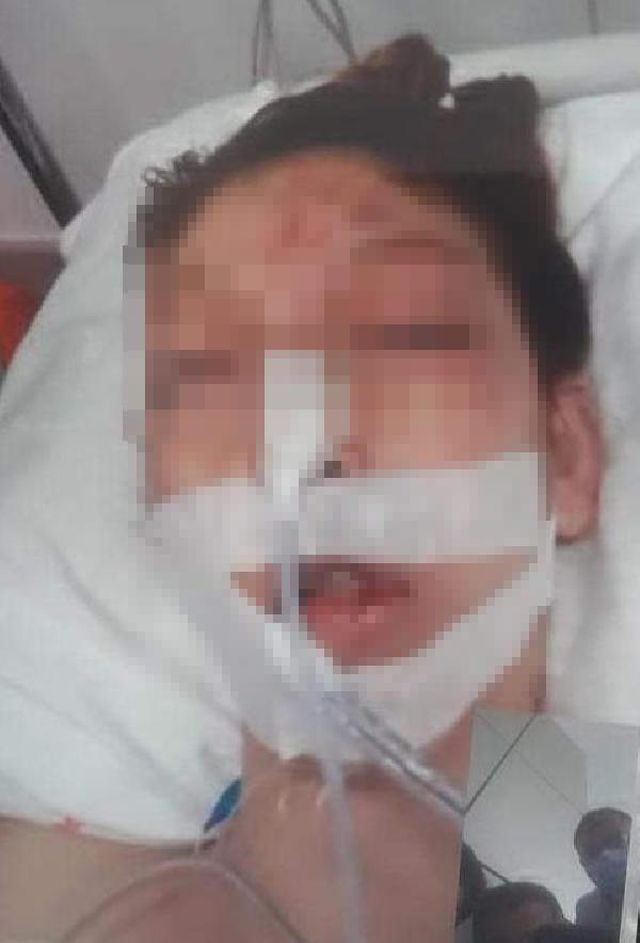 Cinsel istismara kalkışan sapığın ağır yaraladığı kızın babasından yürek yakan sözler