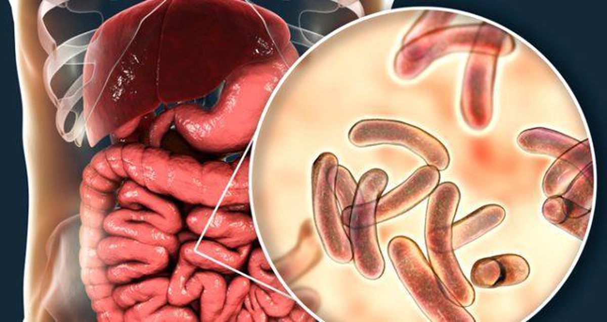 Kolera nedir? Kolera salgını belirtileri nelerdir? Kolera hastalığı nasıl bulaşır? Kolera tedavisi var mı?