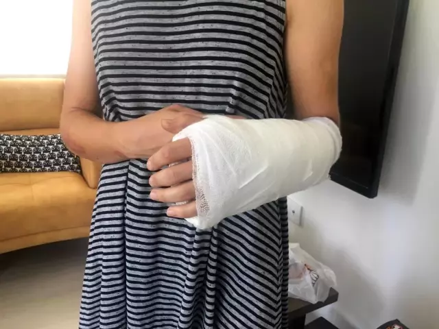 Son dakika! (Özel haber) Skandal yarışta kaza yapan bisikletçi Kübra Bektaş: Organizasyon tam bir fiyaskoydu