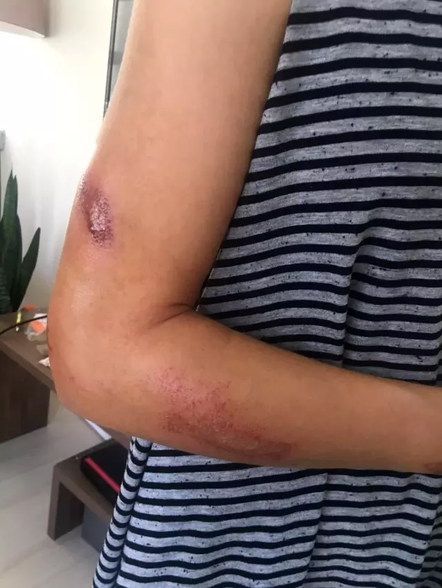 Son dakika! (Özel haber) Skandal yarışta kaza yapan bisikletçi Kübra Bektaş: Organizasyon tam bir fiyaskoydu