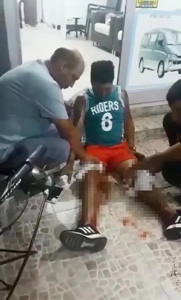 BACAKLARINDAN VURULDU, YERDE OTURARAK AMBULANSI BEKLEDİ
