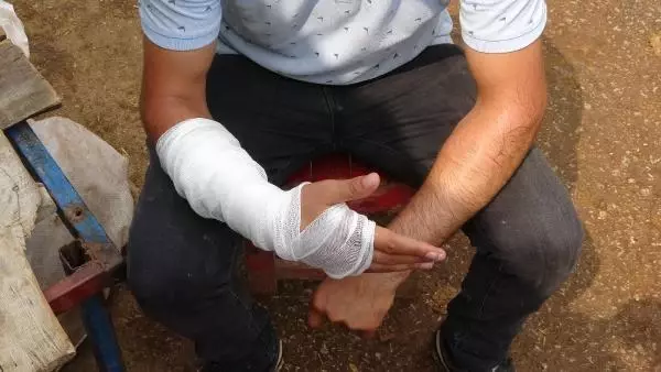 KURBANLIK PAZARLIĞI SIRASINDA KOLU ÇATLADI
