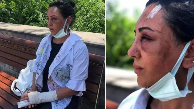 Spor eğitmeni kadın, eski sevgilisi tarafından 20 dakika boyunca takside darbedildi Spor eğitmeni kadın, eski sevgilisi tarafından 20 dakika boyunca takside darbedildi