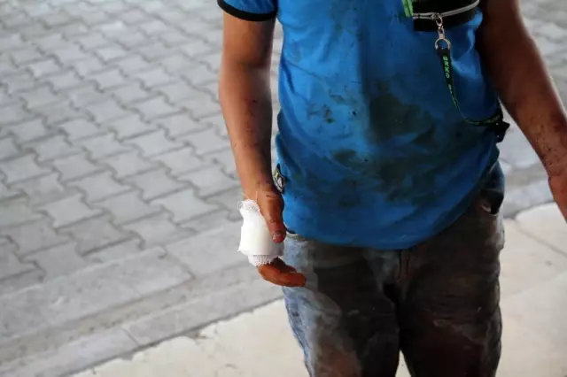 Babasına kurban kesmek için yardım eden çocuk elini kesti