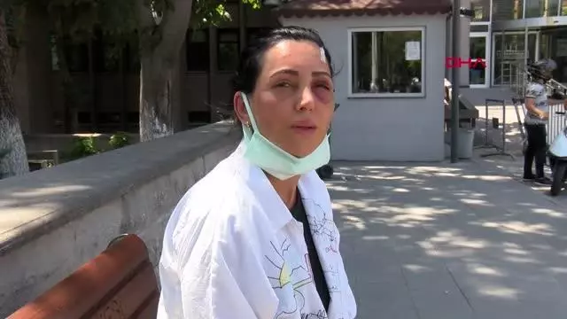 ESKİ SEVGİLİSİNİN TAKSİDE DÖVDÜĞÜ HABİBE 20 DAKİKA BOYUNCA DARBETTİ