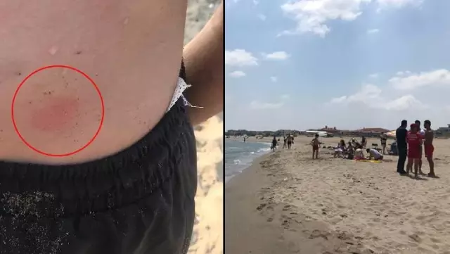 Karasu'da inceleme tamamlandı: Deniz suyu temiz, kaşınma vakalarının sebebi deniz anası Karasu'da inceleme tamamlandı: Deniz suyu temiz, kaşınma vakalarının sebebi deniz anası