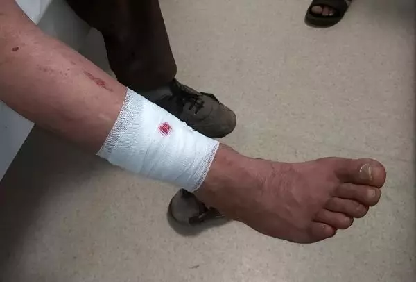 PARMAĞINI KOPARTAN KURDUN BAŞINA TAŞLA VURUP UZAKLAŞTIRDI