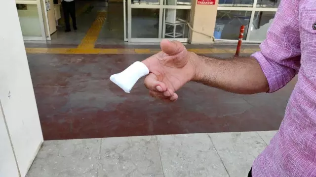 KAHRAMANMARAŞ - 'Acemi kasaplar' hastanelik oldu