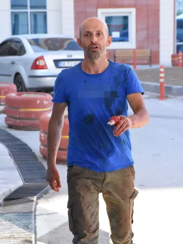Sivas'ta acemi kasaplar, kendilerini yaraladı