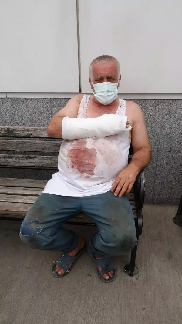 Trabzon'da belediye başkanı, kurban keserken yaralandı