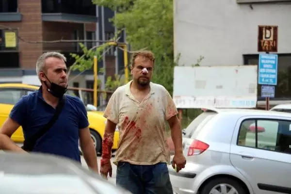 Zonguldak'ta acemi kasaplar hastanelik oldu, 1 kişinin parmağı koptu Zonguldak'ta acemi kasaplar hastanelik oldu, 1 kişinin parmağı koptu