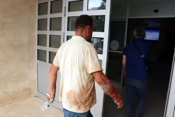 Zonguldak'ta acemi kasaplar hastanelik oldu, 1 kişinin parmağı koptu