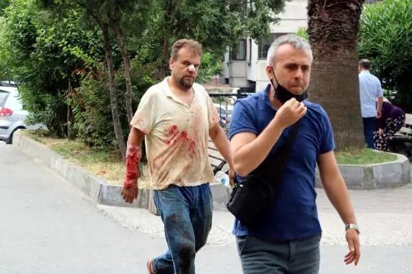 Zonguldak'ta acemi kasaplar hastanelik oldu, 1 kişinin parmağı koptu