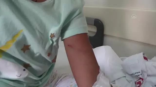 BALIKESİR - Pitbull cinsi köpeğin saldırdığı 8 yaşındaki çocuk yaralandı