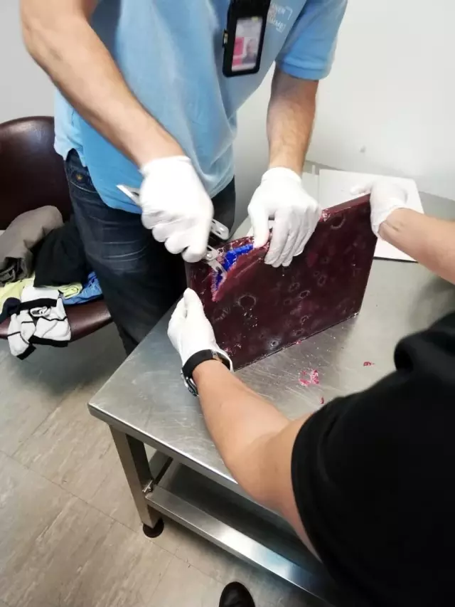Bir kilo kokaini yutan kurye Ukrayna'da yakalandı