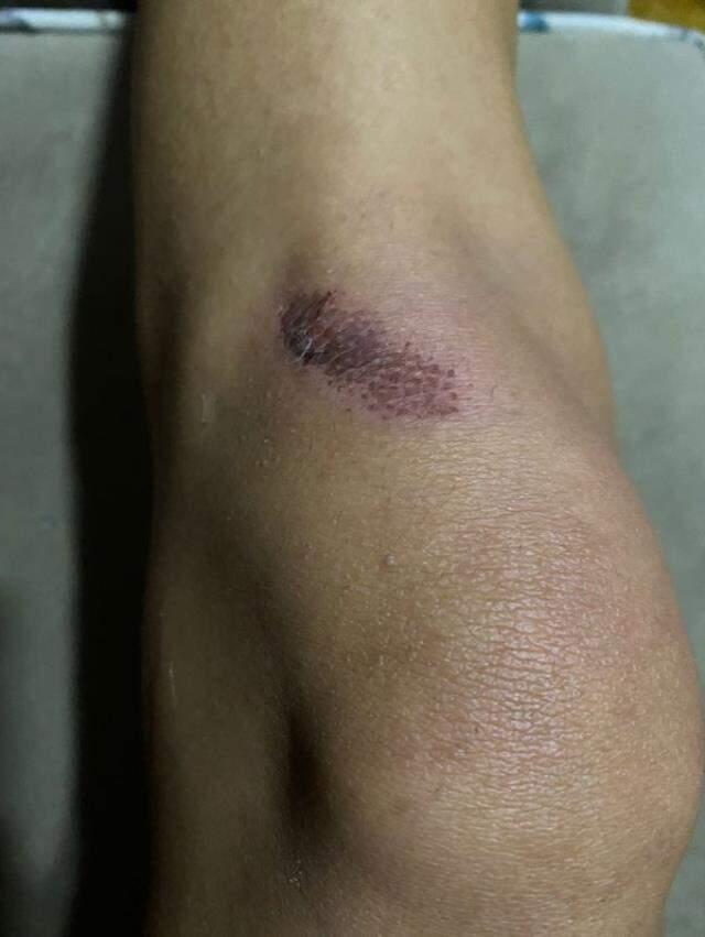 Manken Gizem Akbaş, eğlence kulübünde eski sevgilisi tarafından acımasızca dövüldü! O anlar anbean kaydedildi Manken Gizem Akbaş, eğlence kulübünde eski sevgilisi tarafından acımasızca dövüldü! O anlar anbean kaydedildi