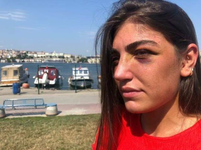 Manken Gizem Akbaş'ı öldüresiye döven eski sevgilisi adliyeye sevk edildi Manken Gizem Akbaş'ı öldüresiye döven eski sevgilisi adliyeye sevk edildi
