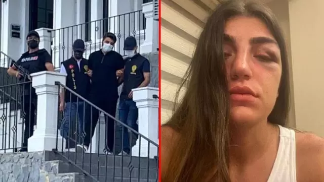 Manken Gizem Akbaş'ı öldüresiye döven eski sevgilisi, ifadesinde her şeyi anlattı: Erkeklerle nispet yapınca darbettim Manken Gizem Akbaş'ı öldüresiye döven eski sevgilisi, ifadesinde her şeyi anlattı: Erkeklerle nispet yapınca darbettim
