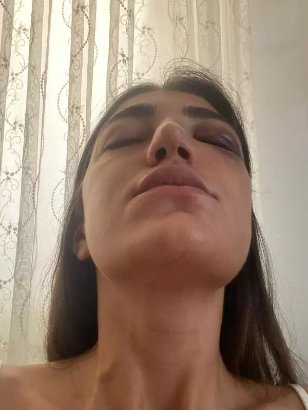 MANKENE ESKİ SEVGİLİ DEHŞETİ ACIMASIZCA DARP ETTİĞİ ANLAR KAMERADA