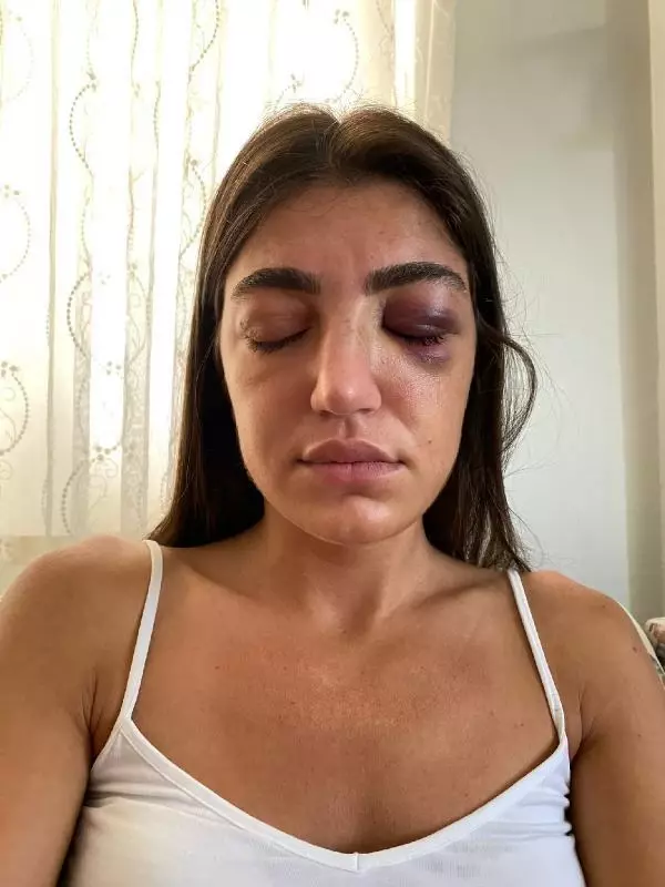 MANKENE ESKİ SEVGİLİ DEHŞETİ ACIMASIZCA DARP ETTİĞİ ANLAR KAMERADA
