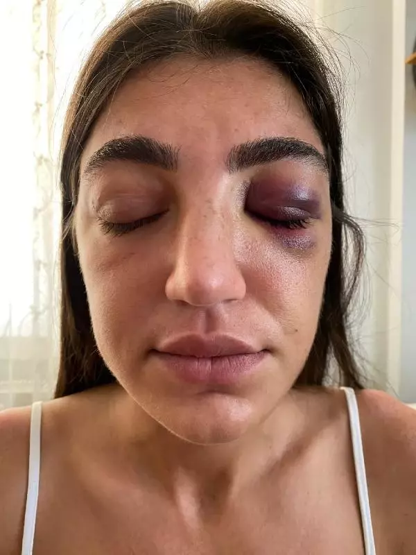 MANKENE ESKİ SEVGİLİ DEHŞETİ ACIMASIZCA DARP ETTİĞİ ANLAR KAMERADA