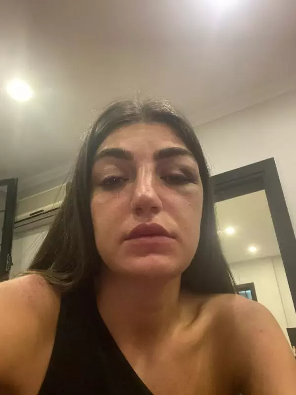MANKENE ESKİ SEVGİLİ DEHŞETİ ACIMASIZCA DARP ETTİĞİ ANLAR KAMERADA