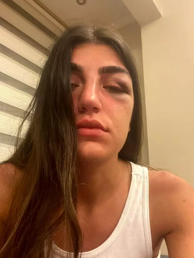 Ünlü mankene öldüresiye dayak kamerada
