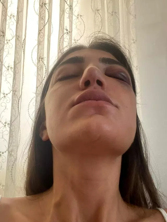Ünlü mankene öldüresiye dayak kamerada